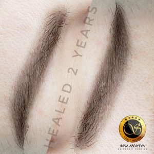 Inna Abdiyeva- Academy-S - Healed works