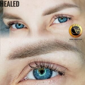 Inna Abdiyeva- Academy-S - Healed works