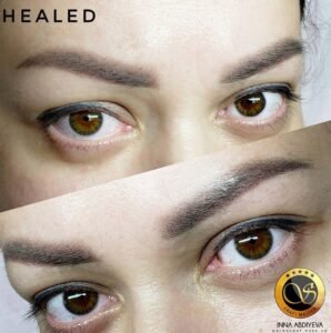 Inna Abdiyeva- Academy-S - Healed works