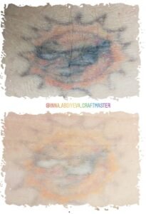Inna Abdiyeva- Tattoo removal