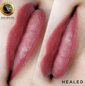 Inna Abdiyeva- Academy-S - Healed works