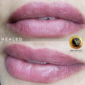 Inna Abdiyeva- Academy-S - Healed works