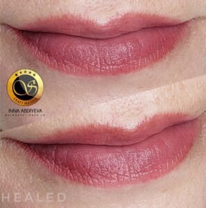 Inna Abdiyeva- Academy-S - Healed works