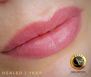 Inna Abdiyeva- Academy-S - Healed works