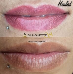 Inna Abdiyeva- Academy-S - Healed works