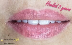 Inna Abdiyeva- Academy-S - Healed works